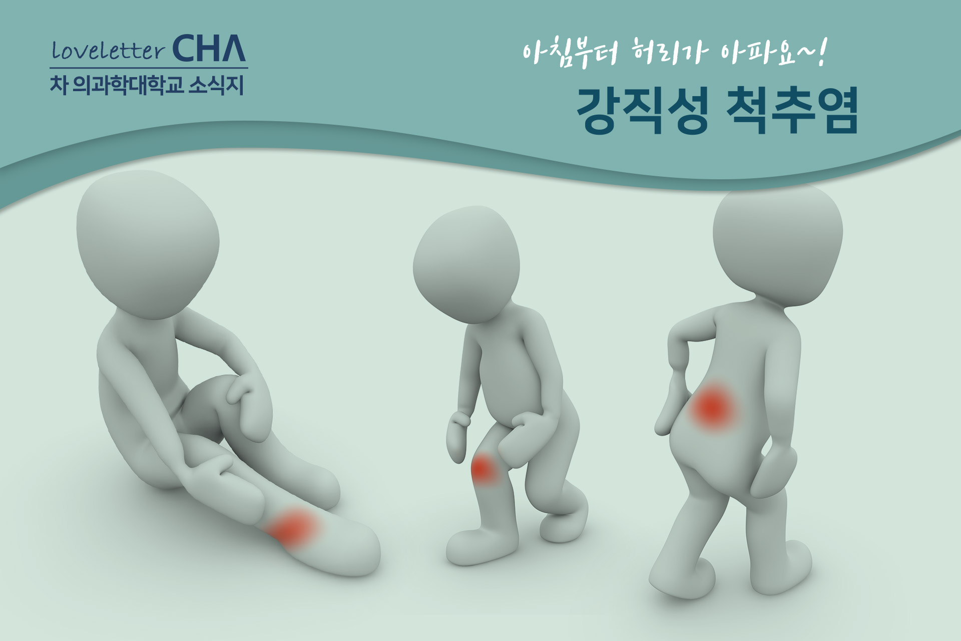 아침에 허리 통증이 심하고 척추염이 있습니까?